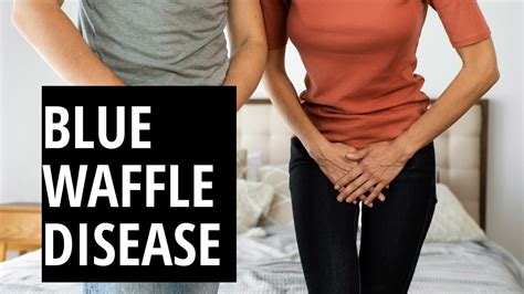 What is the Blue Waffle STD .